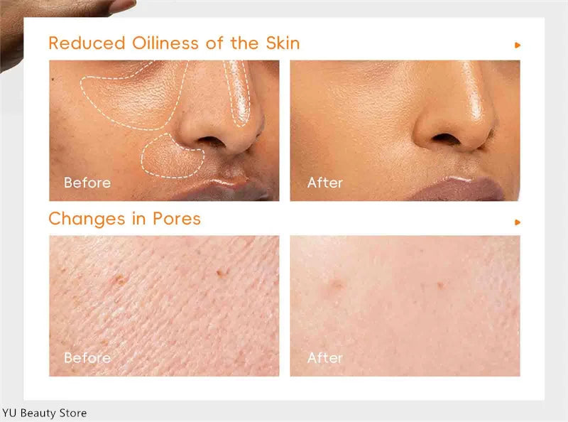 Turmeric Vitamin C Clay Mask Deep Cleansing Facial Improves Dark Spots Acne Hydrating Skin Care Tightens Skin Evens Skin Tone