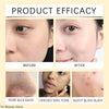 Turmeric Vitamin C Clay Mask Deep Cleansing Facial Improves Dark Spots Acne Hydrating Skin Care Tightens Skin Evens Skin Tone