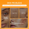 Turmeric Vitamin C Clay Mask Deep Cleansing Facial Improves Dark Spots Acne Hydrating Skin Care Tightens Skin Evens Skin Tone