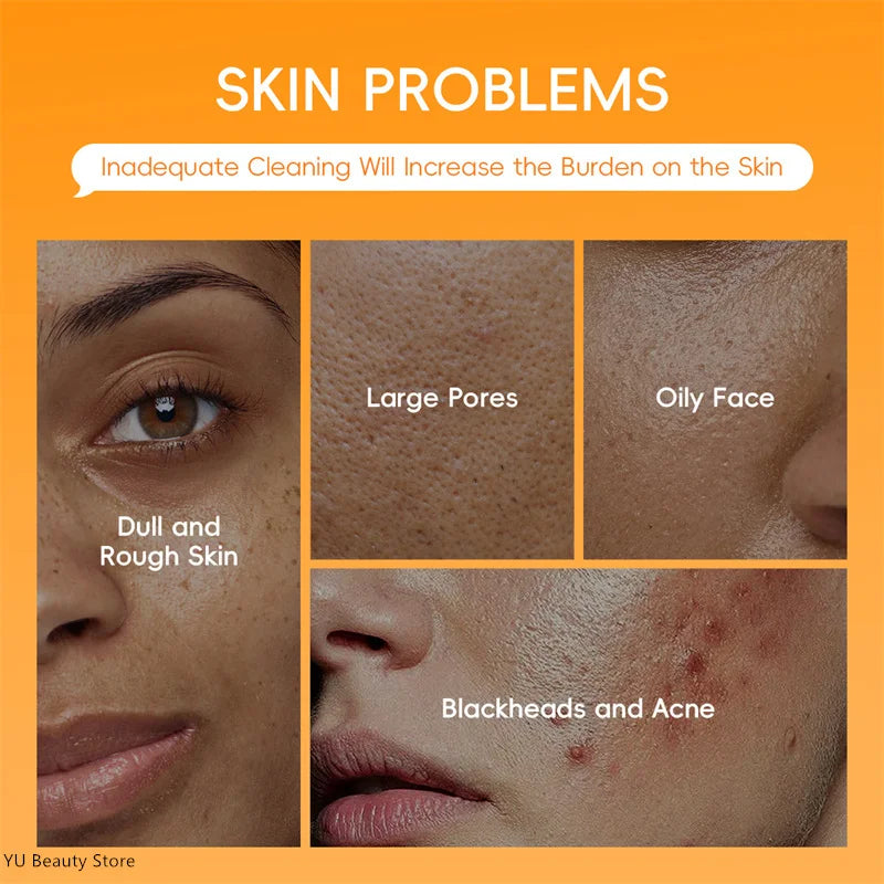 Turmeric Vitamin C Clay Mask Deep Cleansing Facial Improves Dark Spots Acne Hydrating Skin Care Tightens Skin Evens Skin Tone