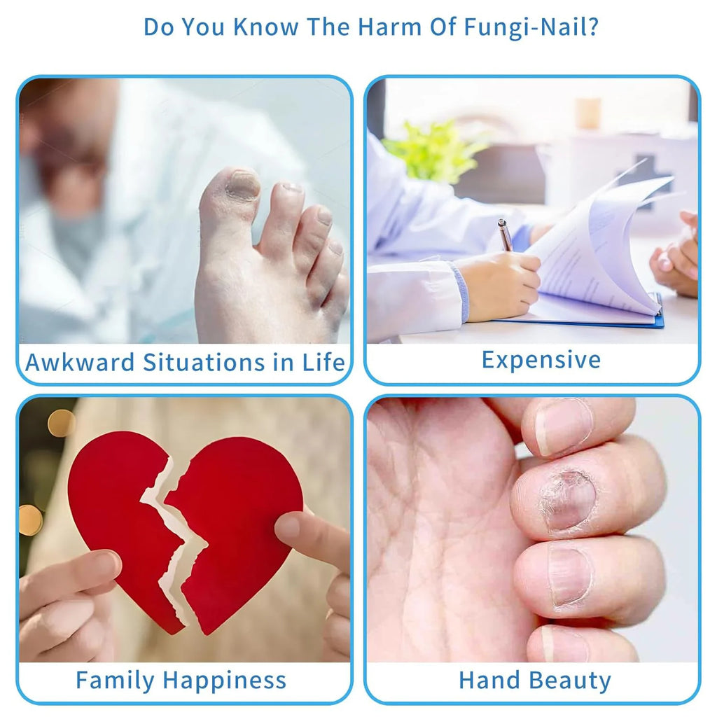 New Household Fungal Nail Laser Device – Toenail Fungus Repair & Nail Care Tool