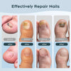 New Household Fungal Nail Laser Device – Toenail Fungus Repair & Nail Care Tool